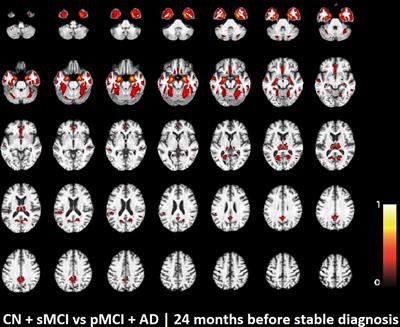 MRI Characterizes the Progressive Course of AD and Predicts Conversion to Alzheimer’s Dementia 24 Months Before Probable Diagnosis